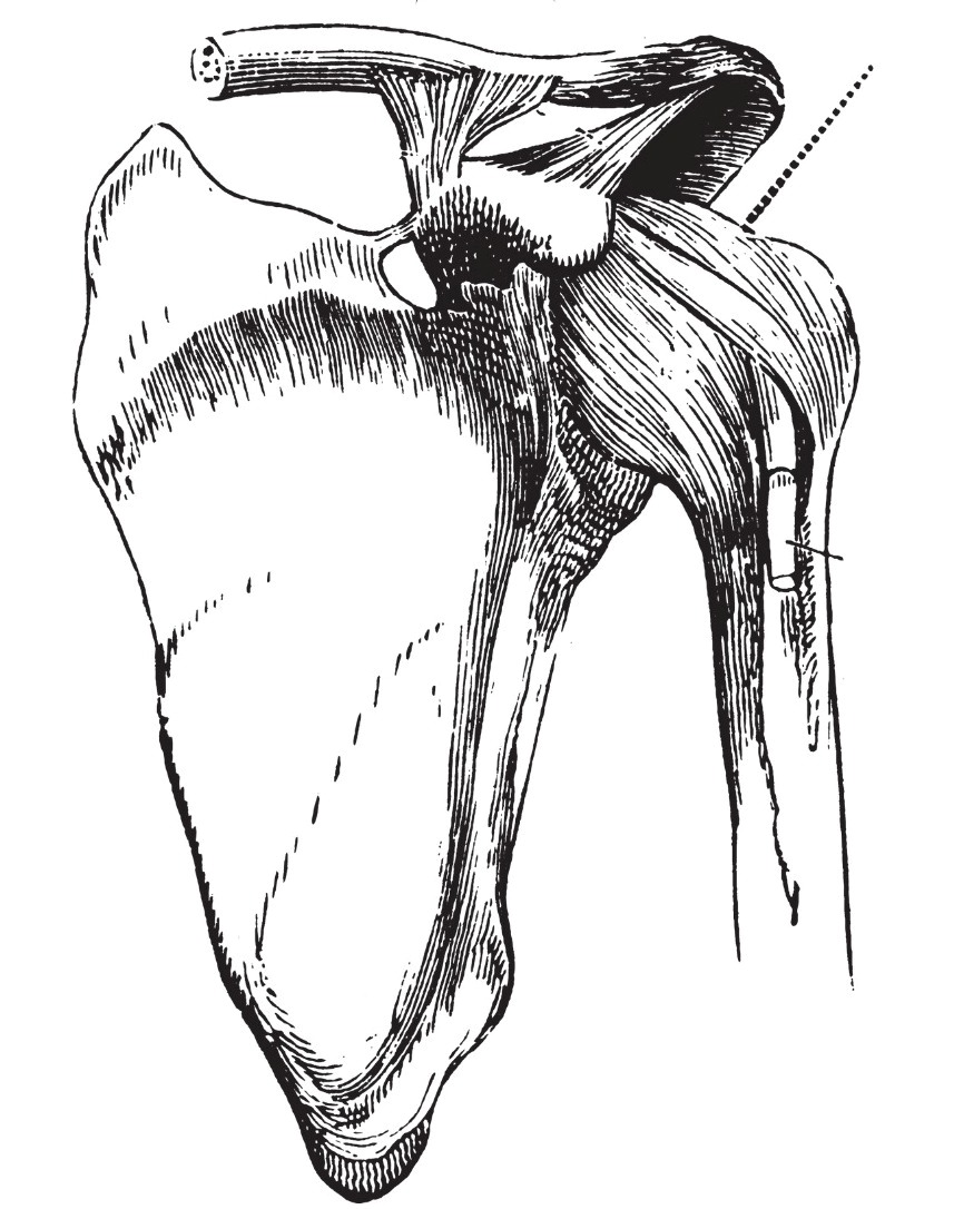 Line drawing of the bone structure of a shoulder joint