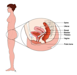 Diagram showing the pelvic floor
